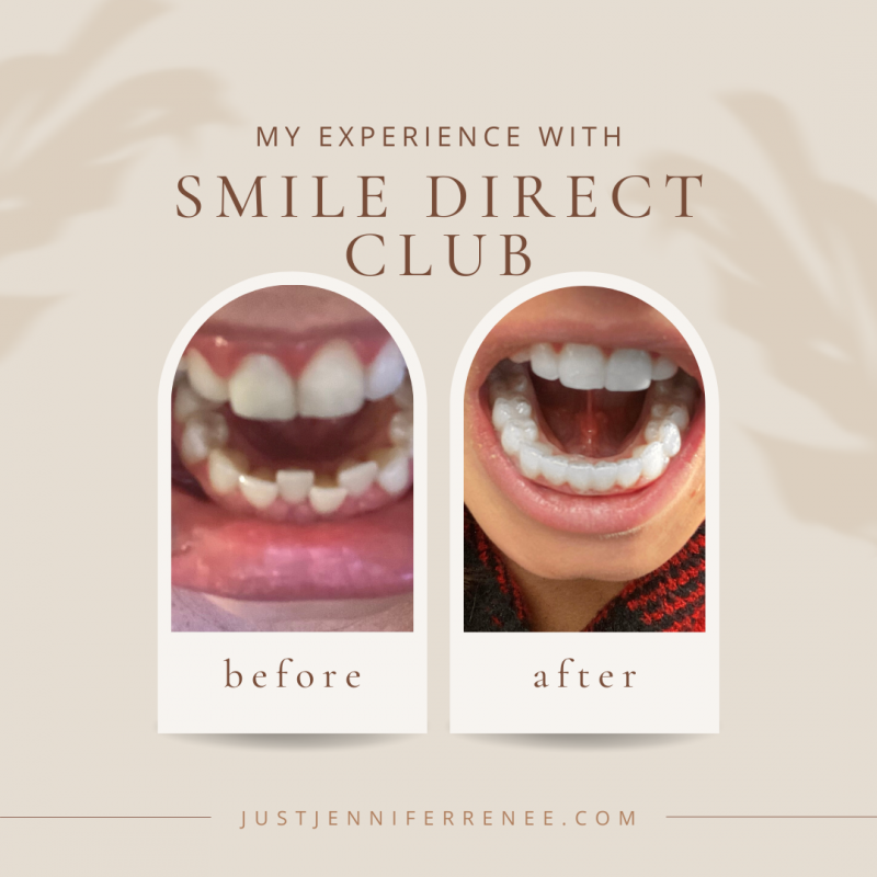 My Review: Smile Direct Club - Just Jennifer Renee